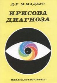 Ирисова диагноза
