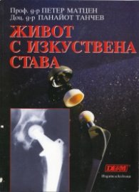 Живот с изкуствена става