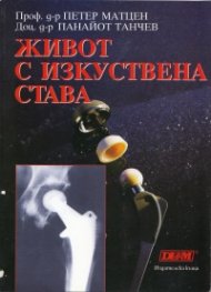 Живот с изкуствена става